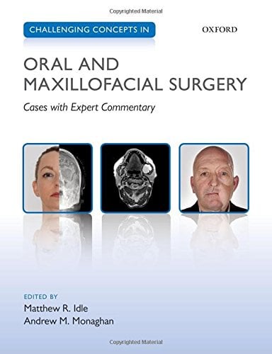 Challenging Concepts in Oral and Maxillofacial Surgery: Cases with Expert Commentary (PDF)