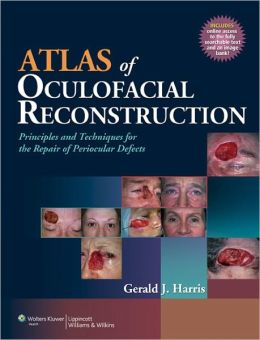 Atlas of Oculofacial Reconstruction: Principles and Techniques for the Repair of Periocular Defects (ORIGINAL PDF from Publisher)
