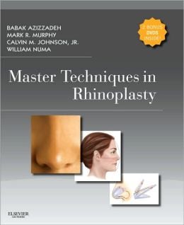 Master Techniques in Rhinoplasty