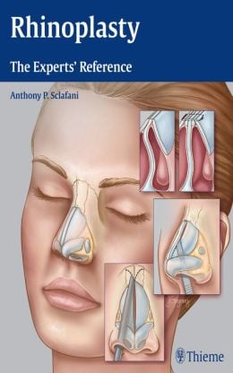 Rhinoplasty: The Experts’ Reference