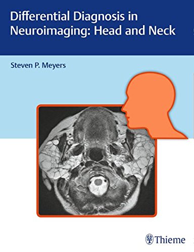 Differential Diagnosis in Neuroimaging: Head and Neck (PDF)