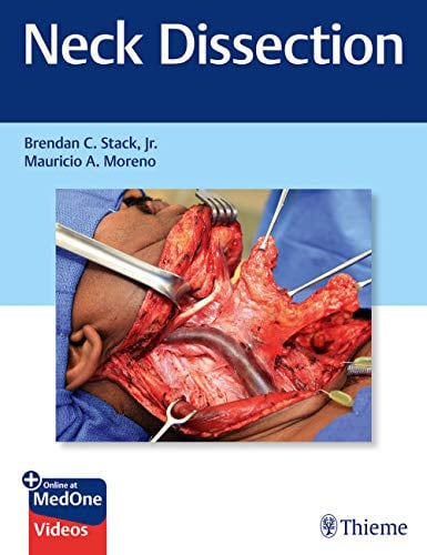 Neck Dissection (PDF+Video)