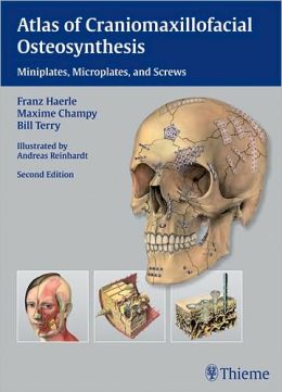 Atlas of Craniomaxillofacial Osteosynthesis: Microplates, Miniplates, and Screws, 2nd Edition