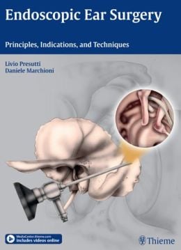 Endoscopic Ear Surgery: Principles, Indications, and Techniques (ORIGINAL PDF from Publisher)
