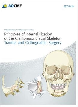 Principles of Internal Fixation of the Craniomaxillofacial Skeleton (Original PDF from Publisher)