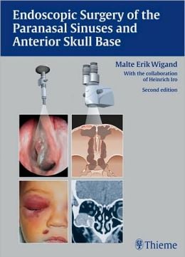 Endoscopic Surgery of the Paranasal Sinuses and Anterior Skull Base, 2nd Edition