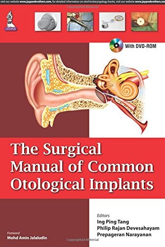 The Surgical Manual of Common Otological Implants