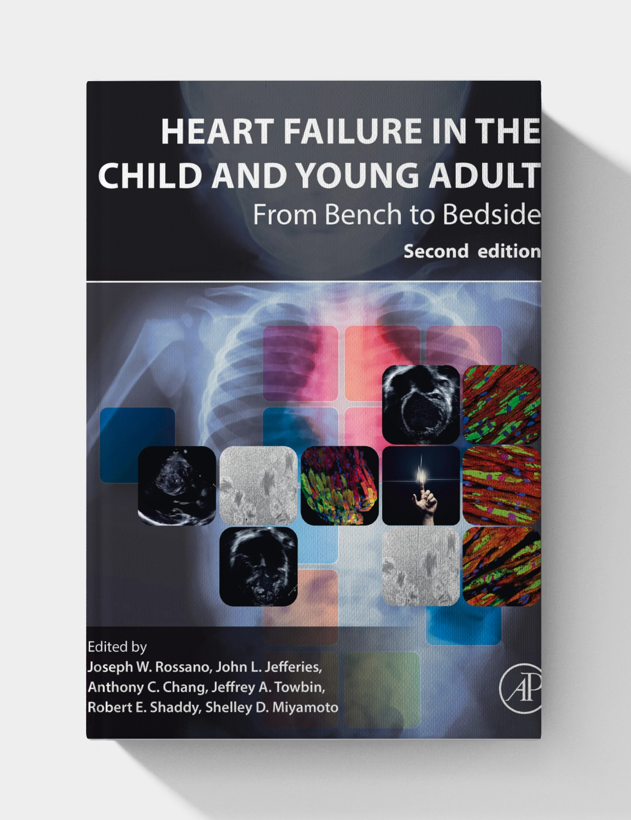 Heart Failure in the Child and Young Adult (2nd Edition)