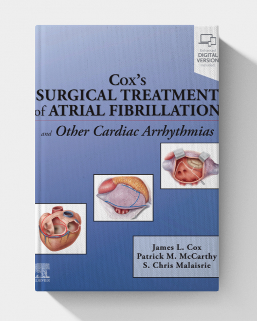 Cox’s Surgical Treatment of Atrial Fibrillation (EPUB)
