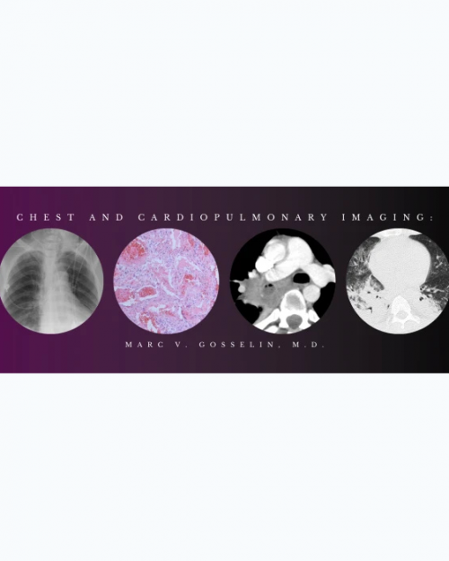 CMEScience Chest and Cardiopulmonary Imaging – Marc V. Gosselin, M.D (Videos + PDF)