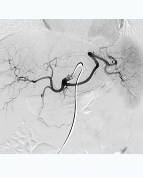NYU Langone Vascular and Interventional Radiology Review and Update 2023 (Videos)