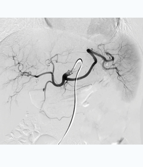NYU Langone Vascular and Interventional Radiology Review and Update 2023 (Videos)