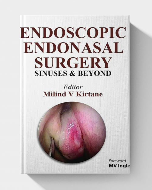 Functional Endoscopic Sinus Surgery