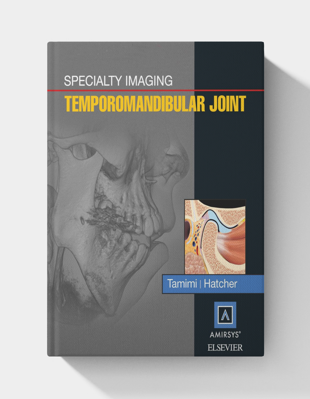 Specialty Imaging: Temporomandibular Joint