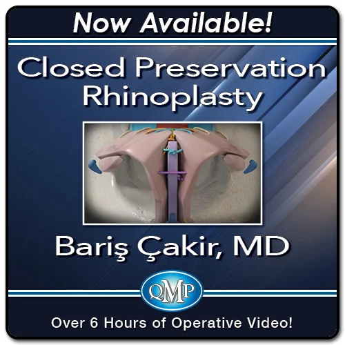 Closed Preservation Rhinoplasty 2023 (Videos