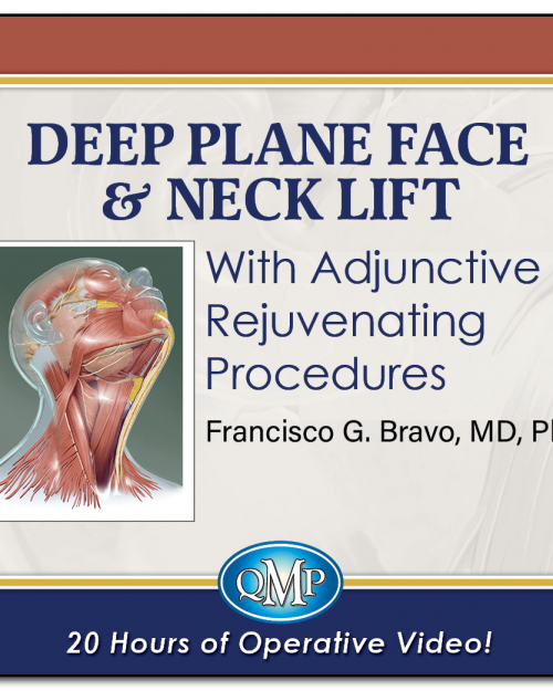 QMP Deep Plane Face & Neck Lift With Adjunctive Rejuvenating Procedures 2025