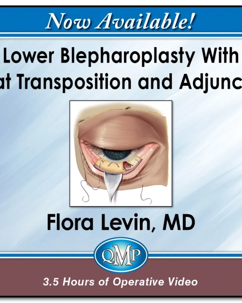 QMP Lower Blepharoplasty With Fat Transposition and Adjuncts 2026