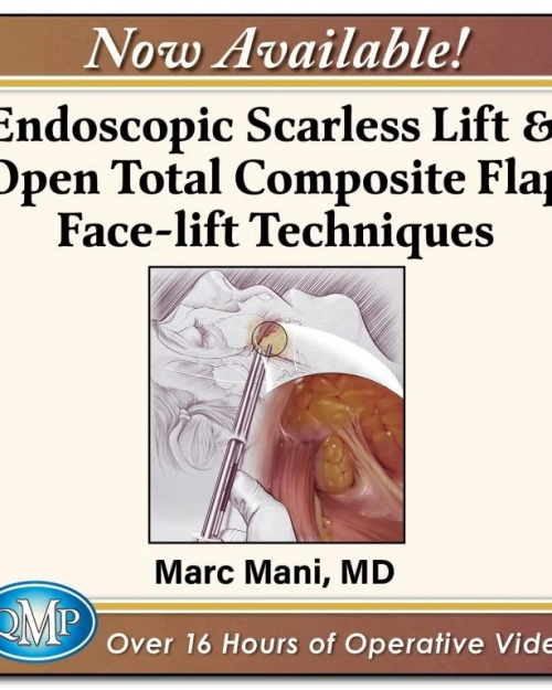 Scarless Endoscopic & Open Composite Plane Face-lifting Techniques 2025