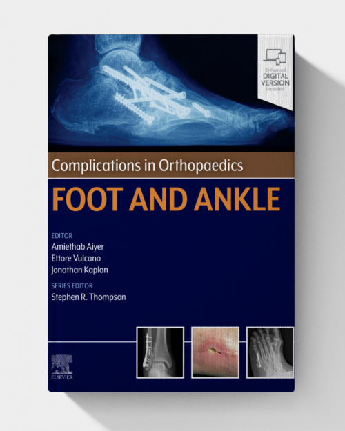 Complications in Orthopaedics: Foot and Ankle (EPUB)