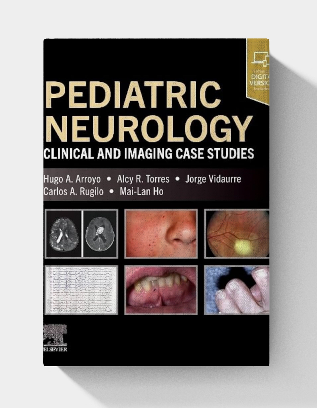 Pediatric Neurology: Clinical and Imaging Case Studies