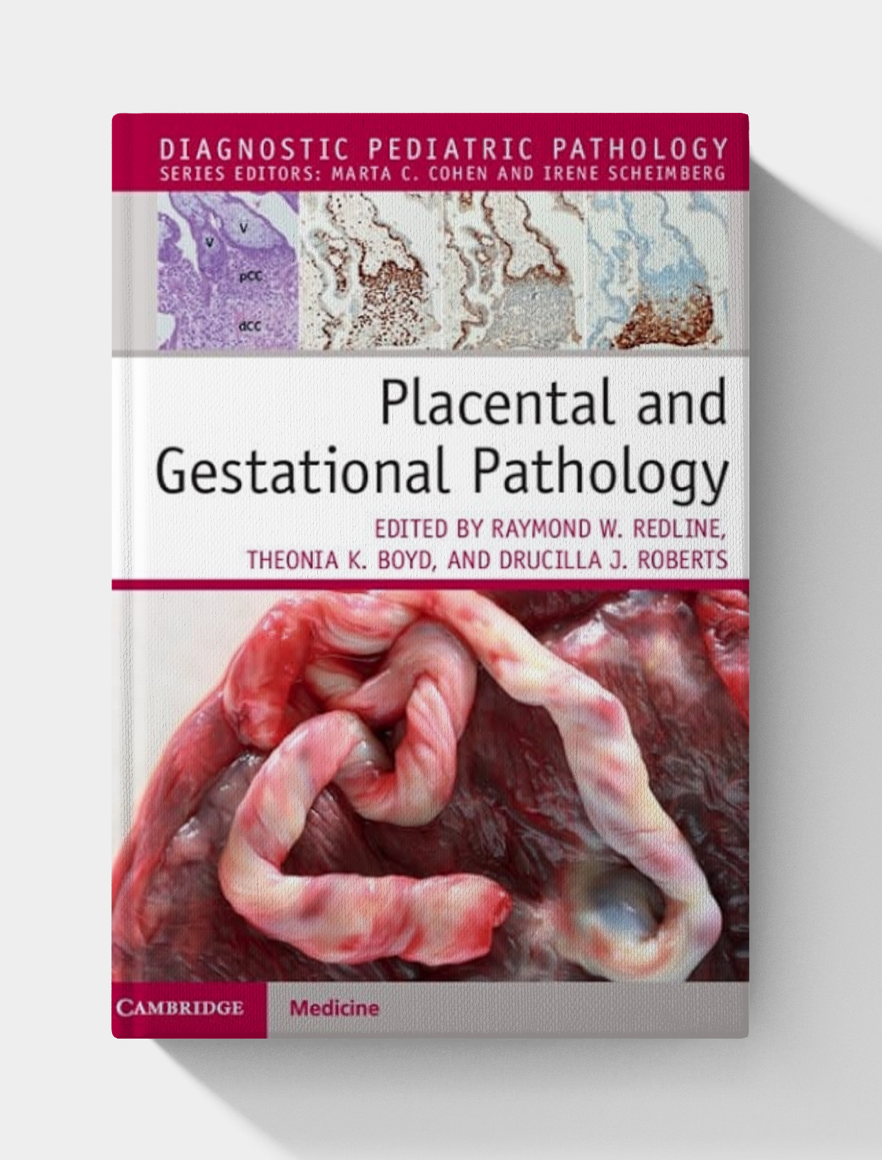 Placental and Gestational Pathology (Diagnostic Pediatric Pathology)