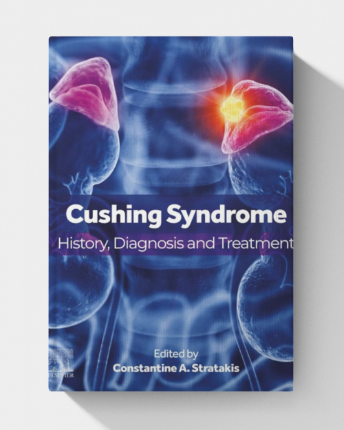 Cushing Syndrome: History, Diagnosis, and Treatment