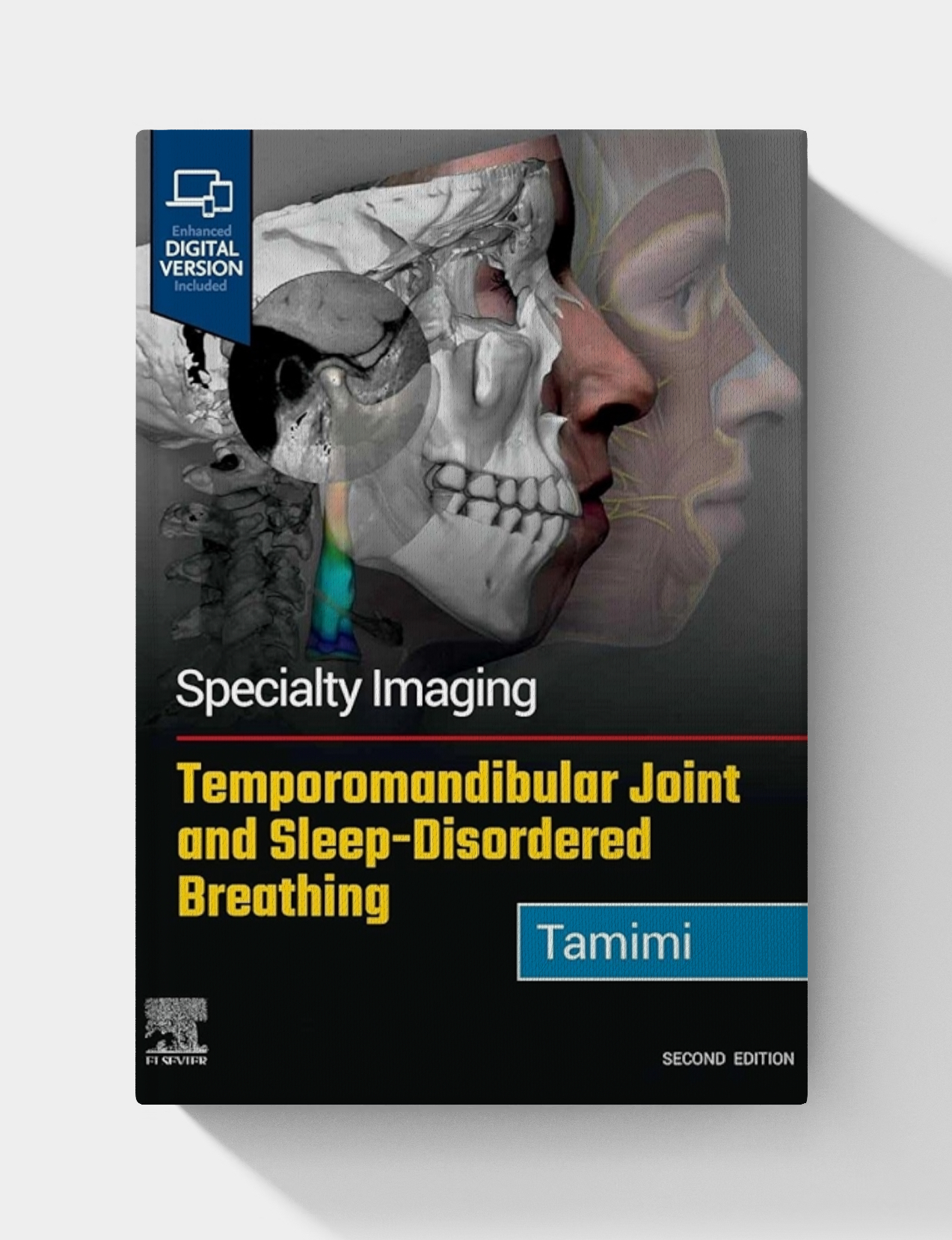 Specialty Imaging: Temporomandibular Joint and Sleep-Disordered Breathing (2nd edition)