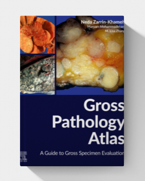 Gross Pathology Atlas: A Guide to Gross Specimens Evaluation