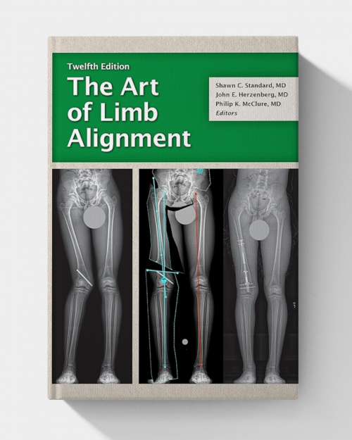 The Art of Limb Alignment  (12th edition)
