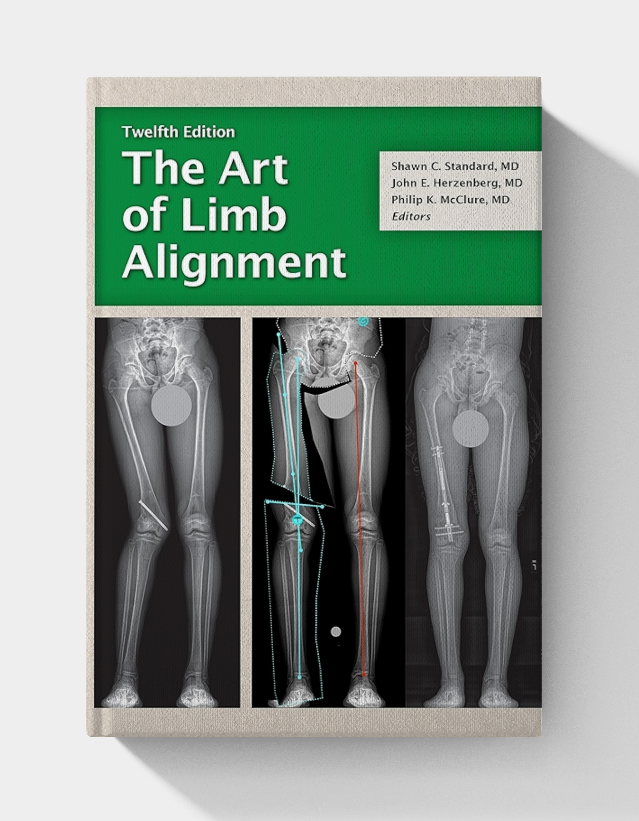 The Art of Limb Alignment (12th edition)