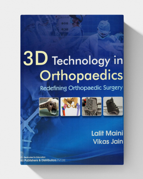 3D Technology in Orthopedics