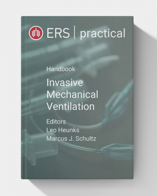 ERS Practical Handbook of Invasive Mechanical Ventilation  (2nd edition)