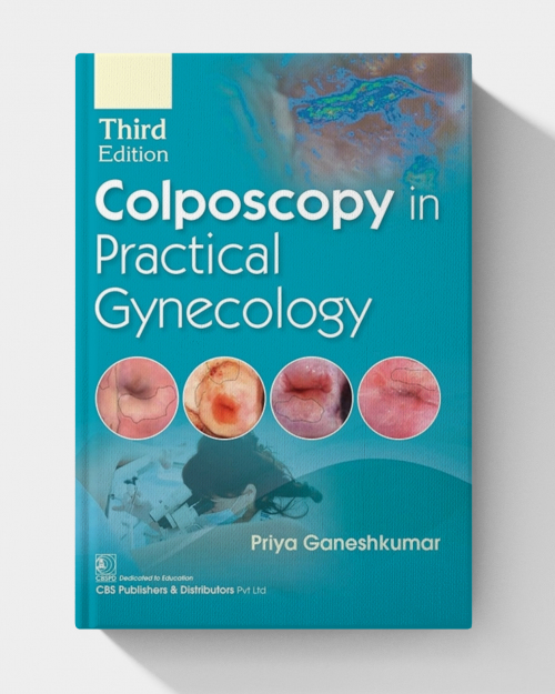 Colposcopy in Practical Gynecology  (3rd Edition)