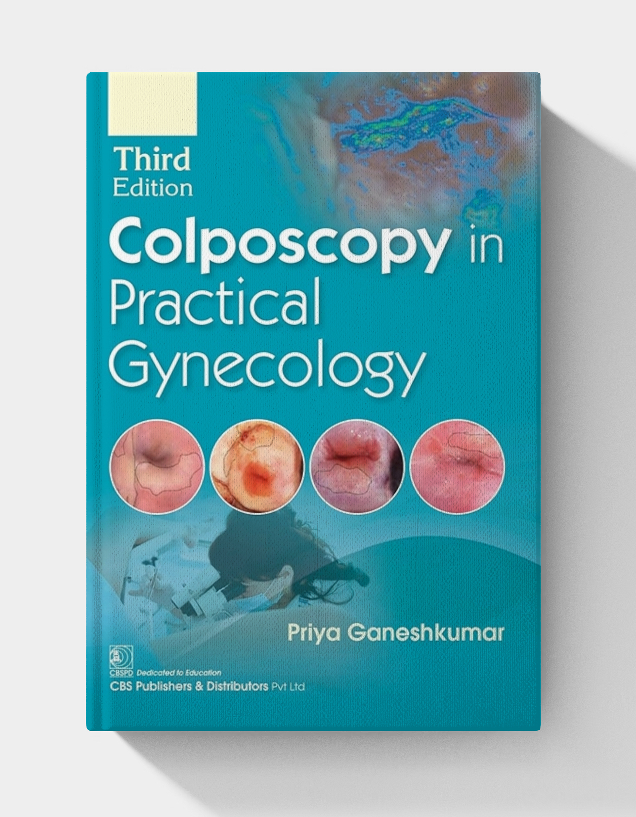 Colposcopy in Practical Gynecology (3rd Edition)