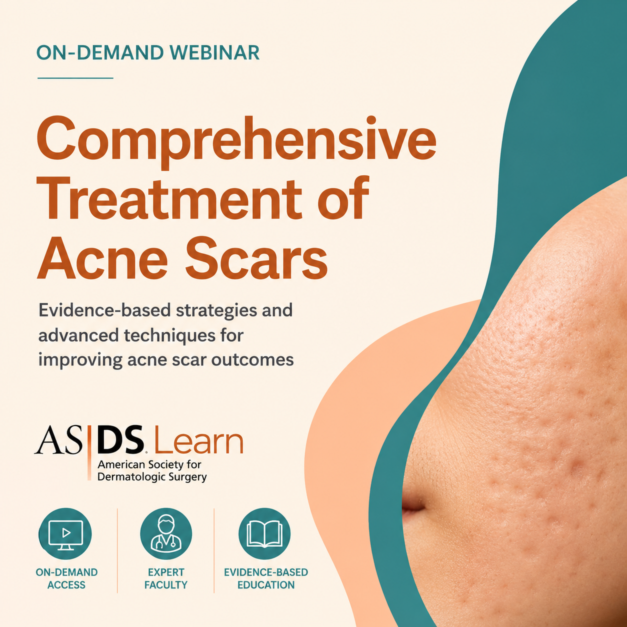 American Society for Dermatologic Surgery Comprehensive Treatment of Acne Scars