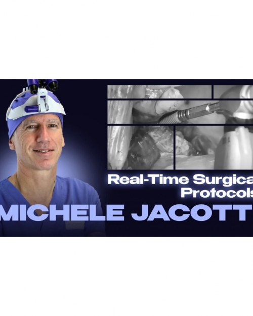 Real-Time Surgical Protocols: Sinus Lift, GBR, and Implant Placement. Step-by-Step Demonstrations from A to Z (Videos)