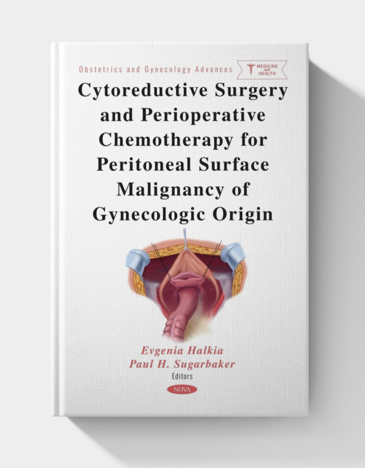 Cytoreductive Surgery and Perioperative Chemotherapy for Peritoneal Surface Malignancy of Gynecologic Origin