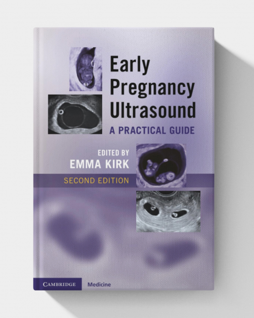 Early Pregnancy Ultrasound: A Practical Guide  (2nd edition)
