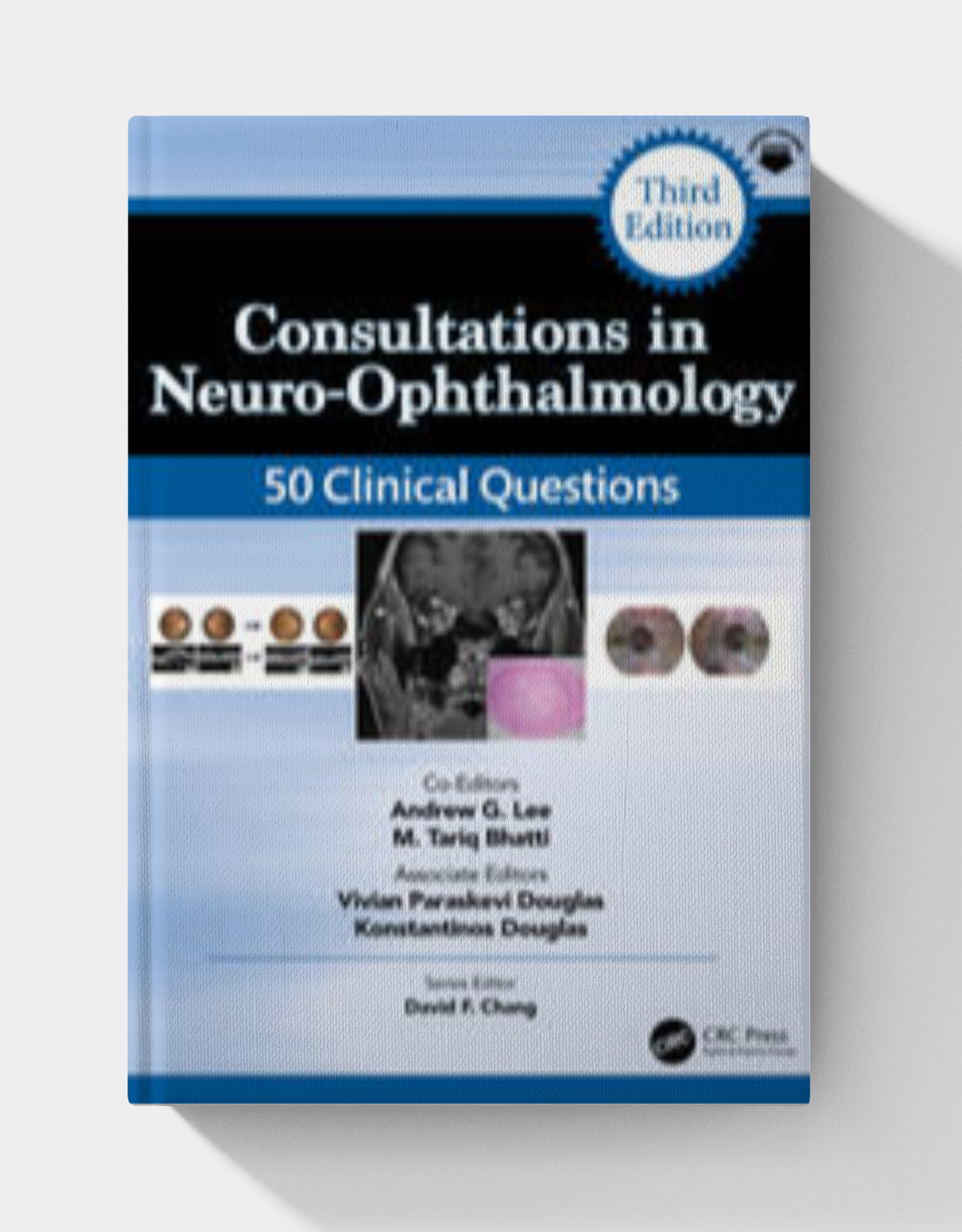 Consultations in Neuro-Ophthalmology: 50 Clinical Questions (3rd edition)