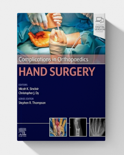 Complications in Orthopaedics: Hand Surgery