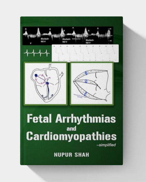 Fetal Arrhythmias and Cardiomyopathies – simplified