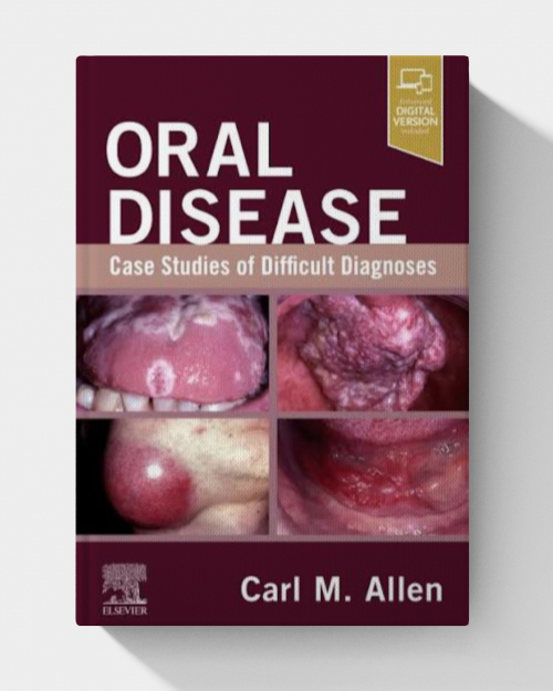 Oral Disease: Case Studies of Difficult Diagnoses (EPUB)