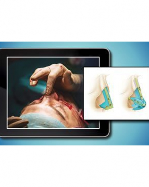 QMP e Learning Program – plastic surgery