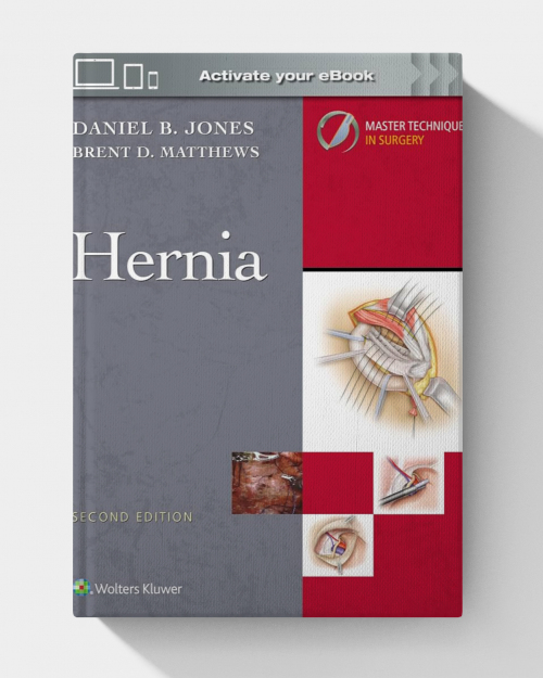 Master Techniques in Surgery: Hernia, 2nd Edition (EPUB + VIDEOS)