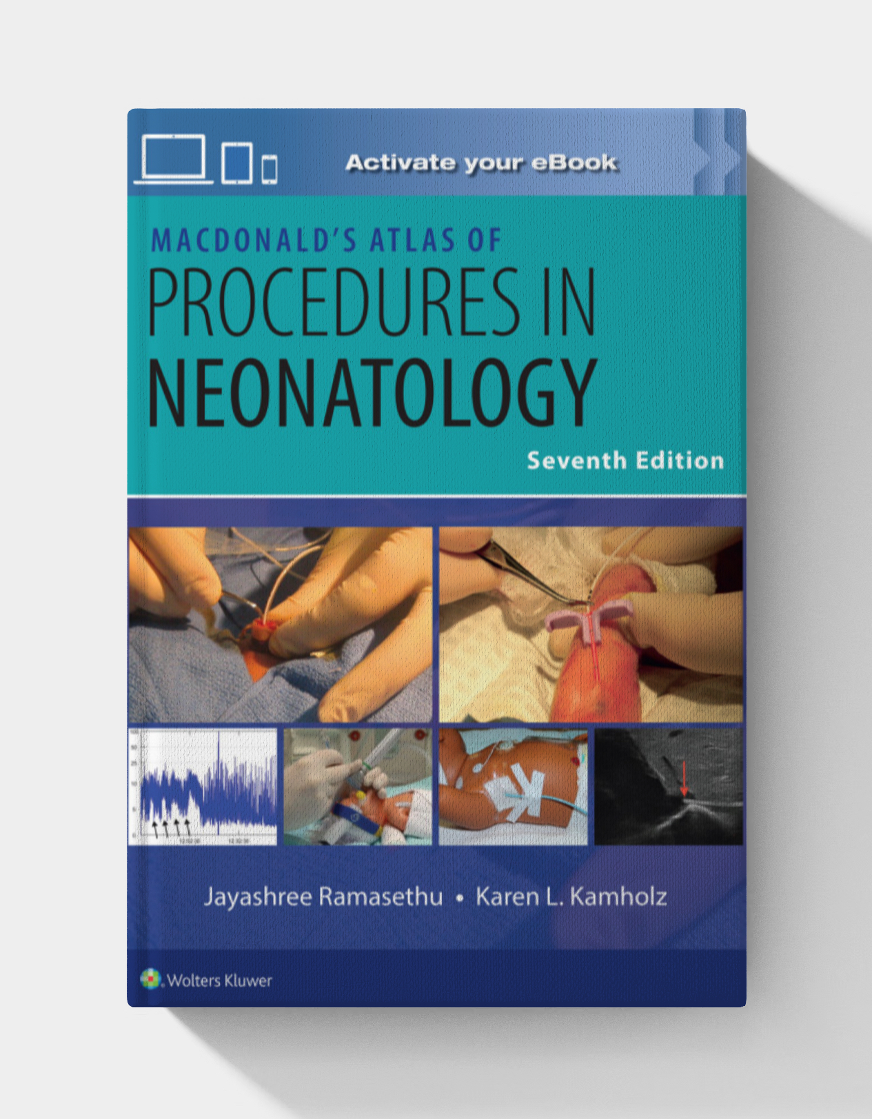 MacDonald’s Atlas of Procedures in Neonatology, 7th edition (EPUB)
