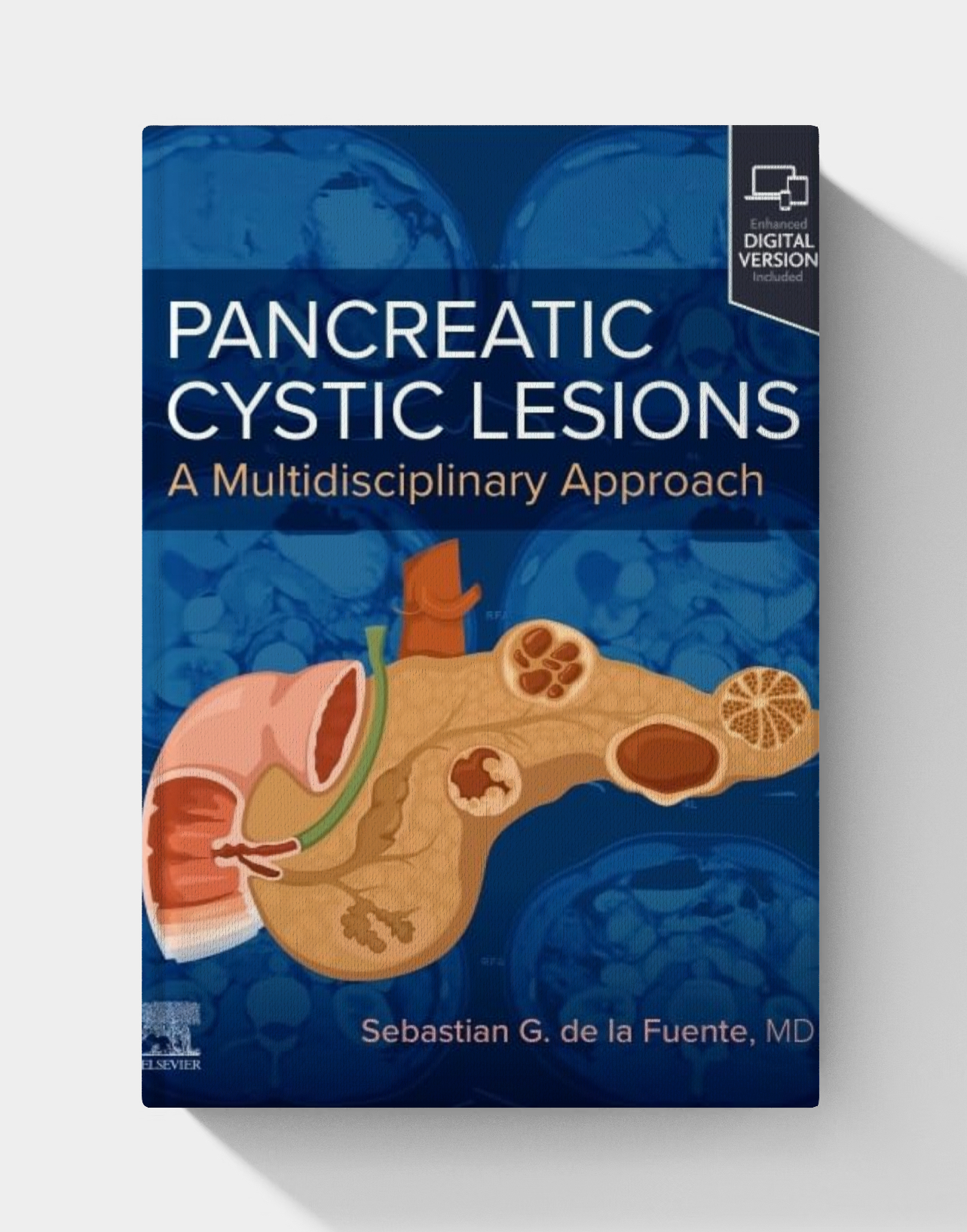 Pancreatic Cystic Lesions: A Multidisciplinary Approach (True PDF)