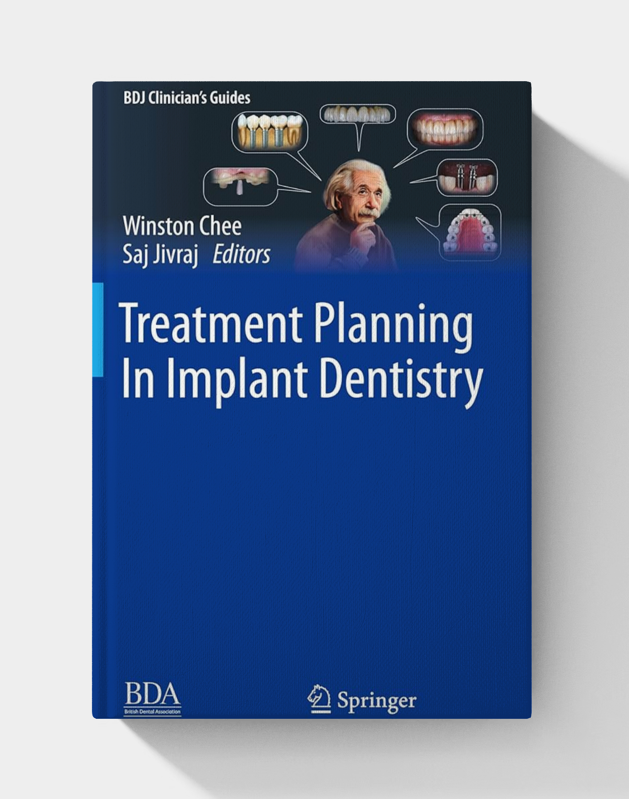 Treatment Planning In Implant Dentistry (BDJ Clinician’s Guides), 2nd edition