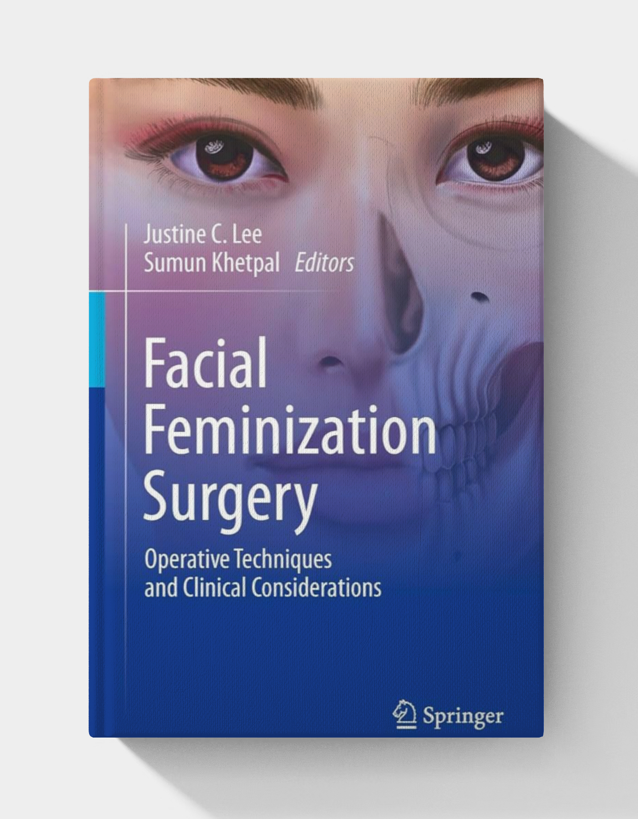 Facial Feminization Surgery: Operative Techniques and Clinical Considerations