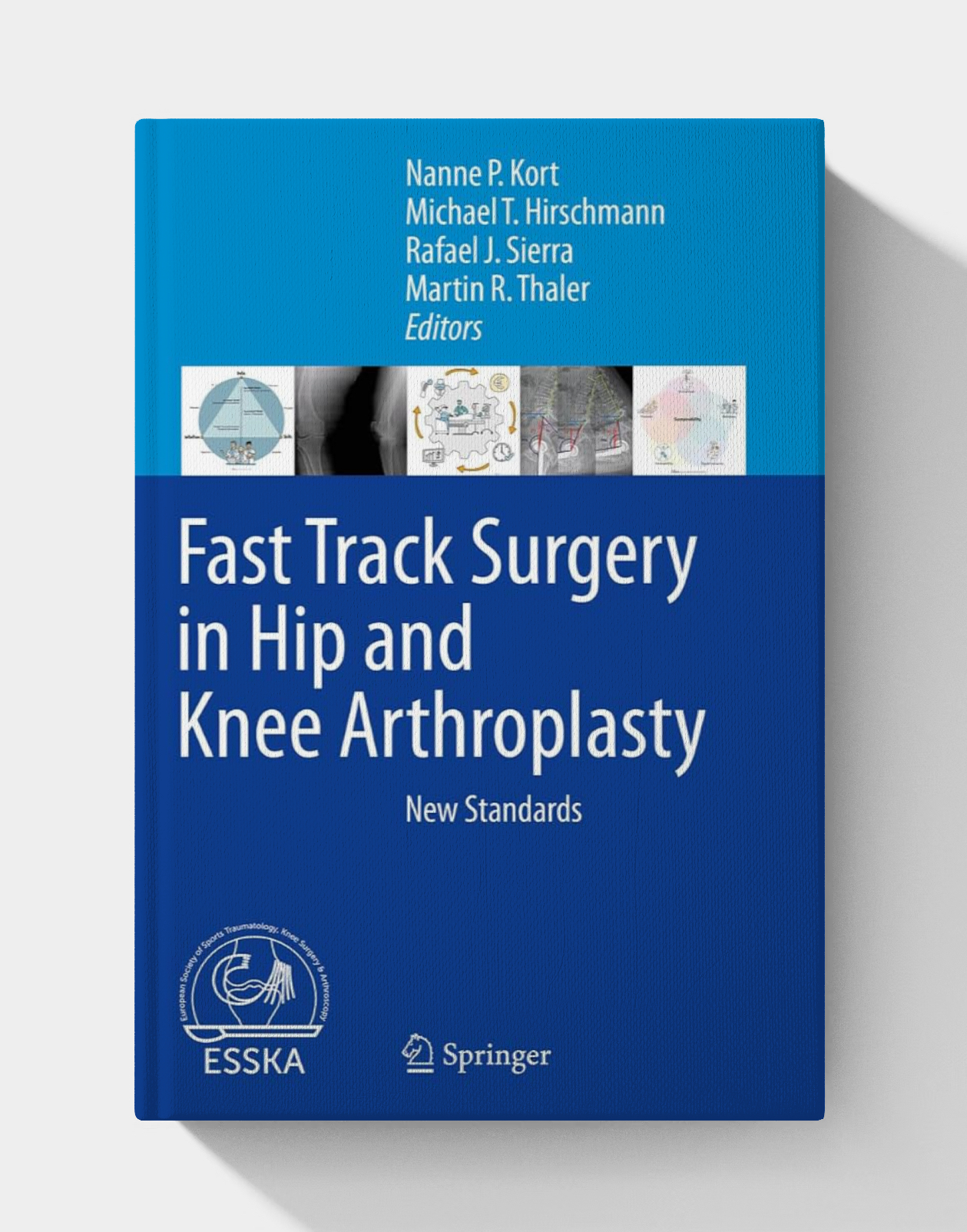 Fast Track Surgery in Hip and Knee Arthroplasty: New Standards