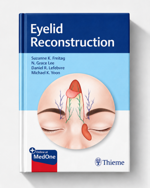Eyelid Reconstruction